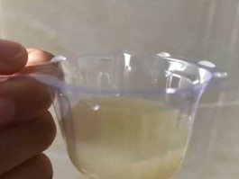 太深了好涨尿进来了？尿颜色深是什么情况？
