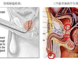 ylmfxp（硬了没发泄膀胱疼怎么回事）