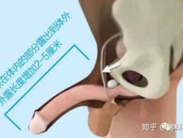 苏州丁丁网 哪个城市有变性手术？