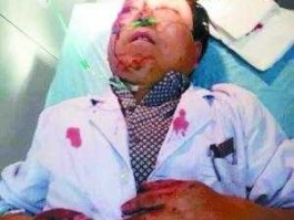 南州事件（南中医死人了？）